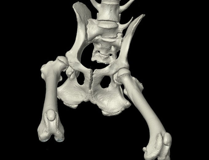 ct_3d_pelvis
