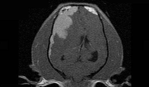 mri_duraltail