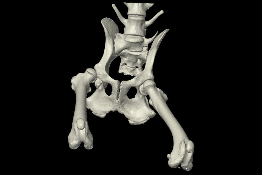 ct_3d_pelvis-2